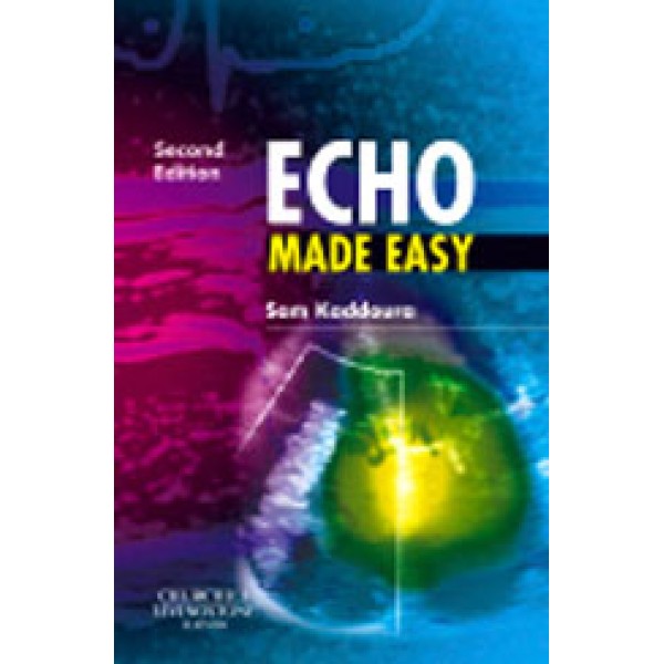 Echo Made Easy, 2nd Edition
