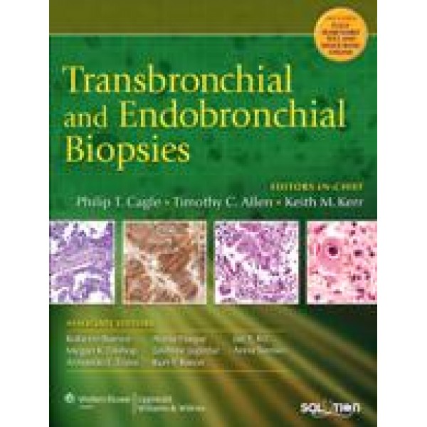 Transbronchial and Endobronchial Biopsies