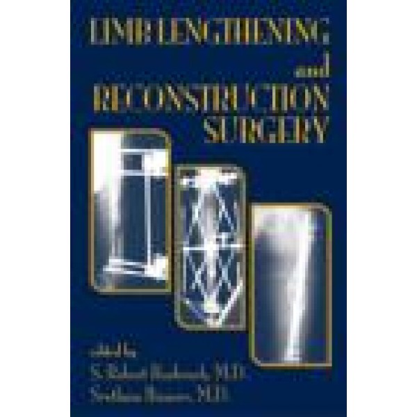 Limb Lengthening and Reconstruction Surgery
