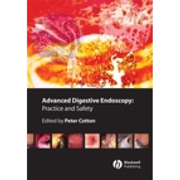 Advanced Digestive Endoscopy: Practice and Safety