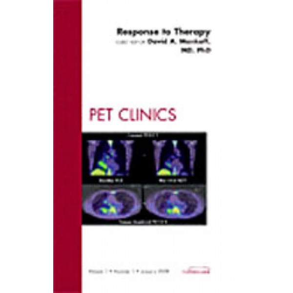Response to Therapy, An Issue of PET Clinics, Volume 3-1