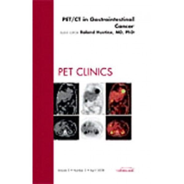 PET/CT in Gastrointestinal Cancer, An Issue of PET Clinics, Volume 3-2
