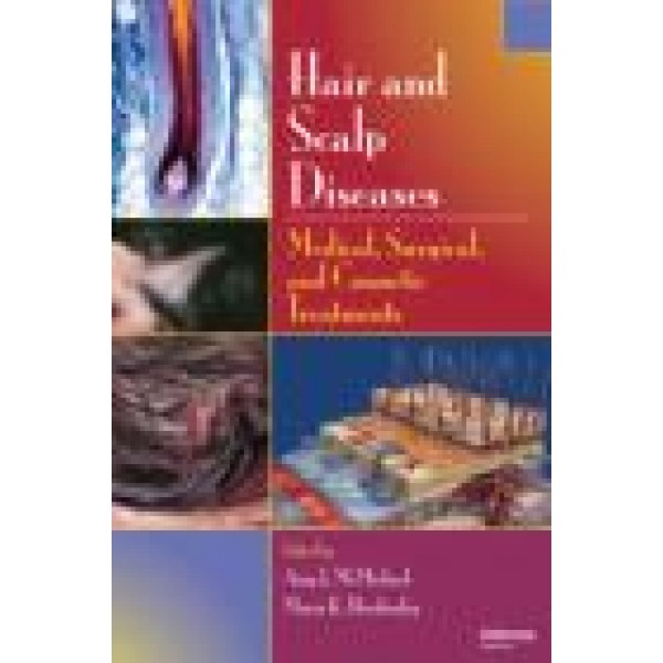 Hair and Scalp Diseases